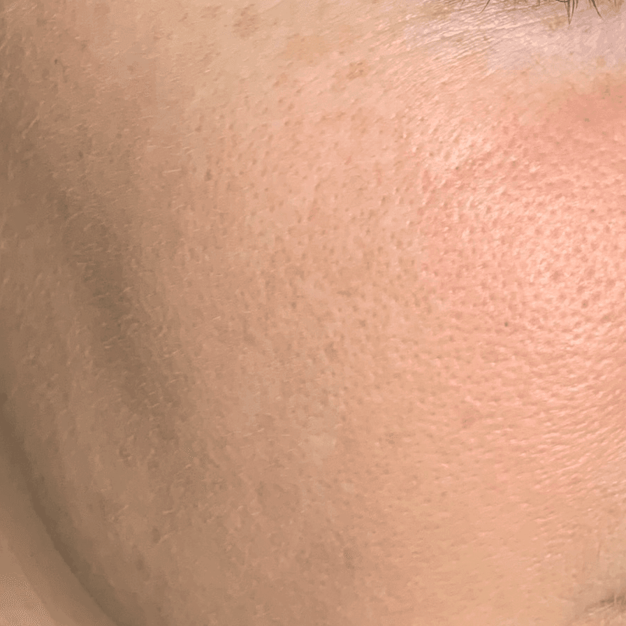 케어 사례 2 after